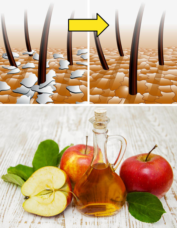 Как яблочный уксус может упростить вашу жизнь: он может поправить ваше здоровье, помочь в хозяйстве и при приготовлении пищи