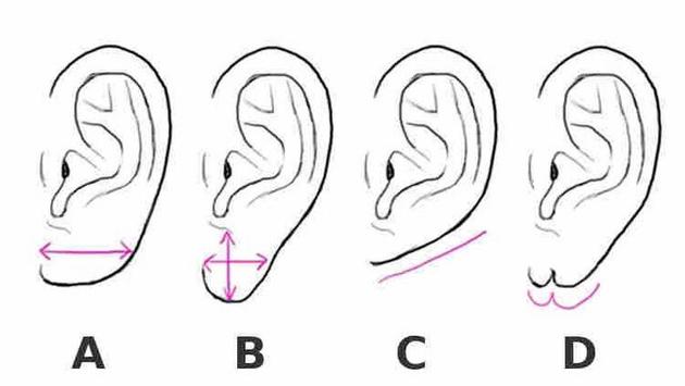 Романтик или эгоист? Что говорит о человеке форма мочки уха