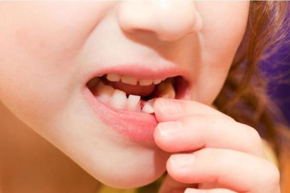 Почему молочные зубы ребенка стоит хранить как зеницу ока: однажды они могут спасти его жизнь