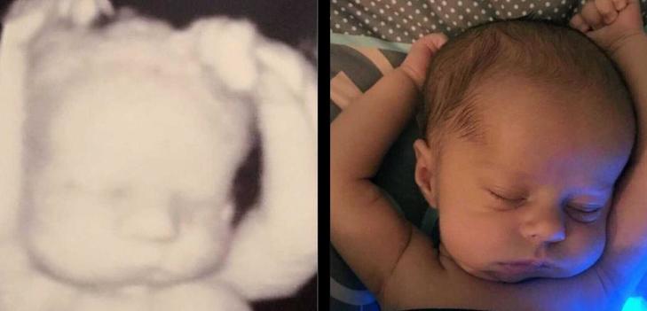 Молодая мама наткнулась на снимок УЗИ своего малыша и сделала забавное сравнение