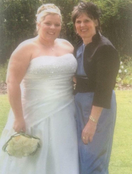 Тучная женщина из Шотландии не могла завязать шнурки, но, похудев почти на 65 кг, готова выйти замуж во второй раз