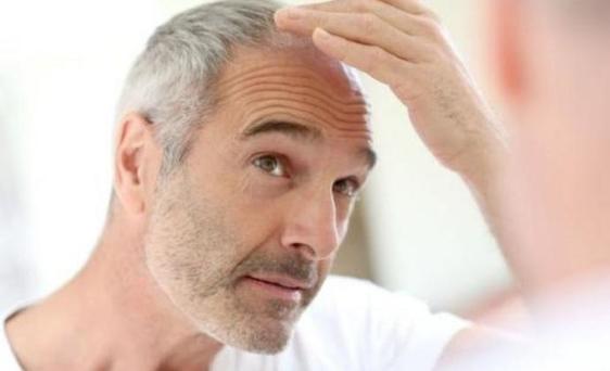 Что делать, чтобы избежать седины: ученые пришли к выводу, что волосы седеют не от старости