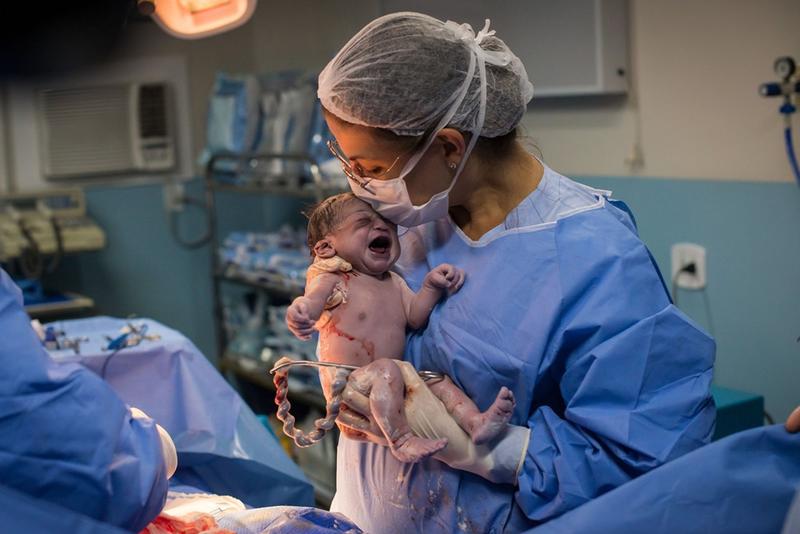 Бразильский новорождённый моментально скопировал взгляд хирурга — и это правда смешно