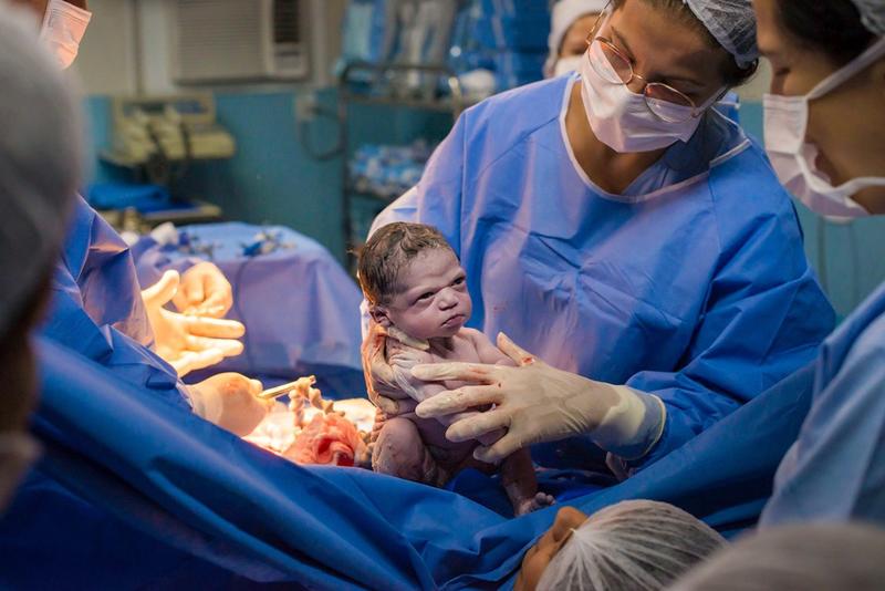 Бразильский новорождённый моментально скопировал взгляд хирурга — и это правда смешно