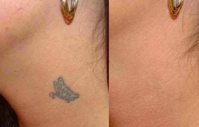 Пошаговый гид: как с помощью консилера, пудры и другой косметики скрыть татуировку