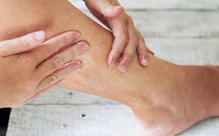 Принимать душ в жару не всегда безопасно: как это делать, чтобы не навредить коже