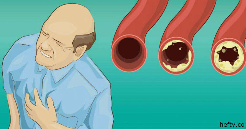 19 продуктов, которые очистят ваши артерии и помогут предотвратить инфаркт