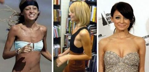 Звезды до и после того, как сделали операцию по увеличению груди