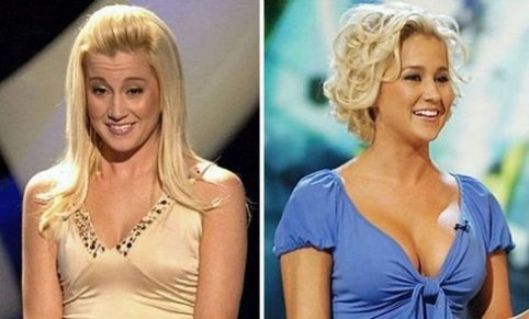 Звезды до и после того, как сделали операцию по увеличению груди