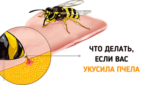 Если вас укусила пчела… Важно знать всем!