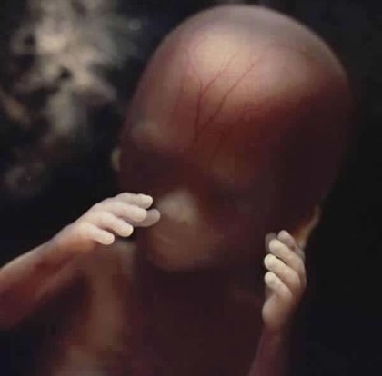 24 фото о том, что происходит внутри женщины все 9 месяцев беременности