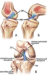 Почему люди приседают по-разному? 